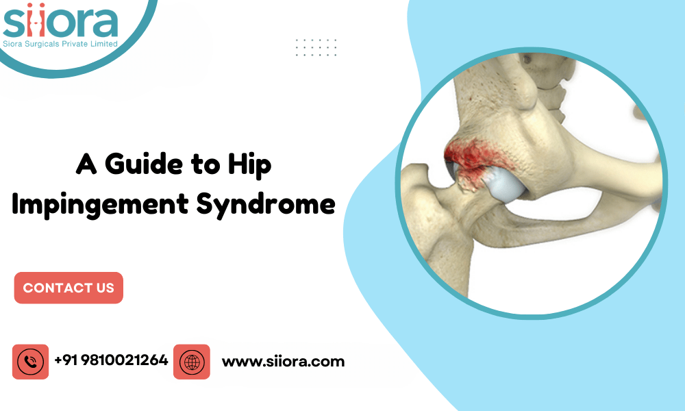 Hip Impingement Syndrome