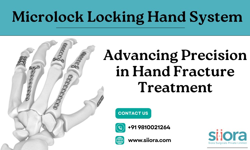 Microlock Locking Hand System