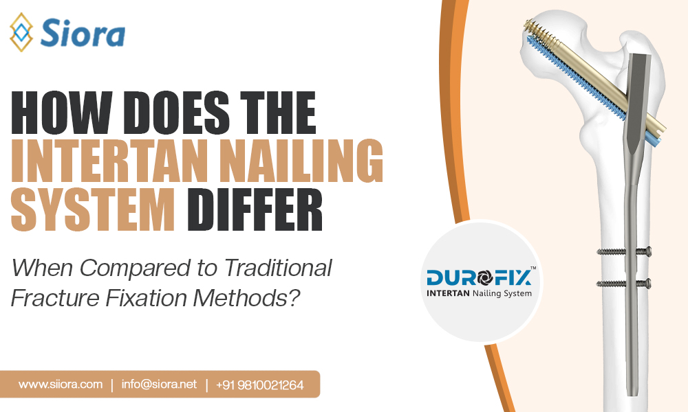 Intertan Nailing System